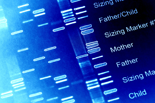 Alpha 1 Antitrypsin Deficiency has a hereditary link.