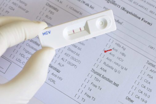 There are many other tests used to diagnose liver disease.