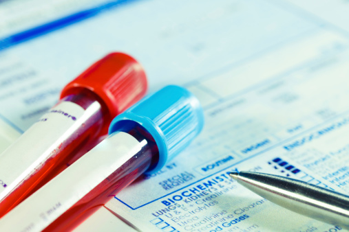Two vials of blood and a medical form for the complete blood count (CBC) test.